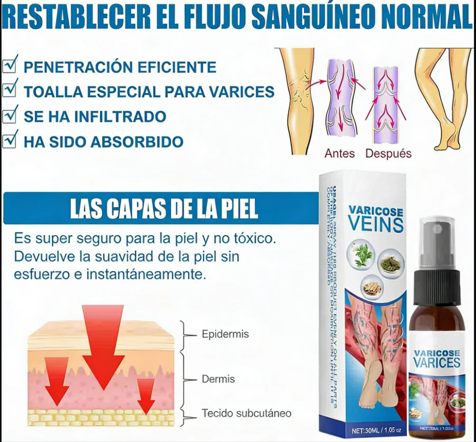 OFERTA ÚNICA 🔥 Spray Milagroso Para Venas Varicosas